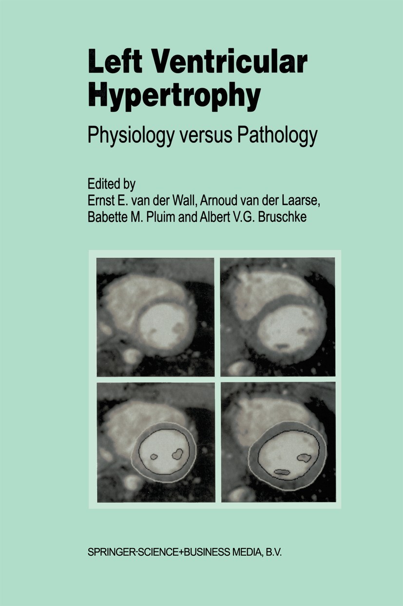 Titlebook: Left Ventricular Hypertrophy; Physiology versus Pa Ernst E. Wall,Arnoud Laarse,Albert V. G. Bruschke Book 1999 Springer Science+Business Me Titlebook: Left Ventricular Hypertrophy; Physiology versus Pa Ernst E. Wall,Arnoud Laarse,Albert V. G. Bruschke Book 1999 Springer Science+Business Me