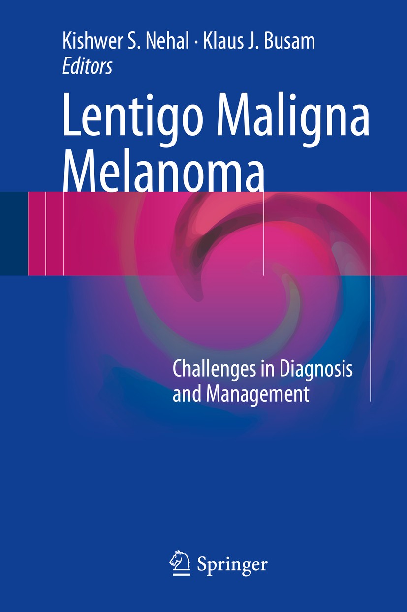 Titlebook: Lentigo Maligna Melanoma; Challenges in Diagno Kishwer S. Nehal,Klaus J. Busam Book 2017 Springer International Publishing Switzerland 2017 Titlebook: Lentigo Maligna Melanoma; Challenges in Diagno Kishwer S. Nehal,Klaus J. Busam Book 2017 Springer International Publishing Switzerland 2017
