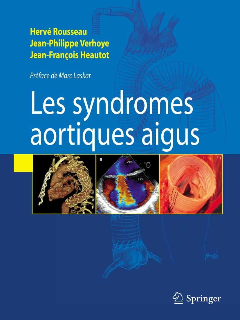 Titlebook: Syndromes aortiques aigus; Hervé Rousseau,Jean-Philippe Verhoye,Jean-François Book 2009Latest edition Springer-Verlag Paris 2009 Dissectio Titlebook: Syndromes aortiques aigus; Hervé Rousseau,Jean-Philippe Verhoye,Jean-François Book 2009Latest edition Springer-Verlag Paris 2009 Dissectio
