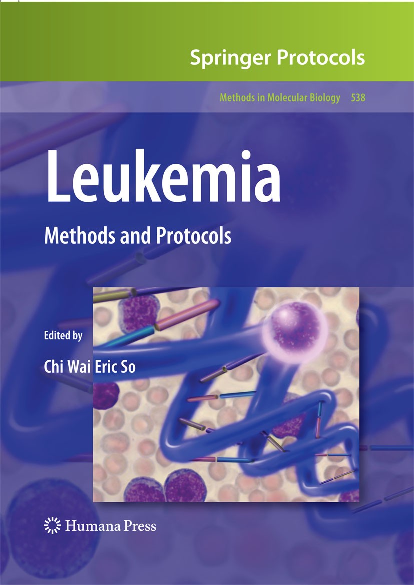 Titlebook: Leukemia; Methods and Protocol Chi Wai Eric So Book 2009 The Editor(s) (if applicable) and The Author(s), under exclusive license to Spring Titlebook: Leukemia; Methods and Protocol Chi Wai Eric So Book 2009 The Editor(s) (if applicable) and The Author(s), under exclusive license to Spring