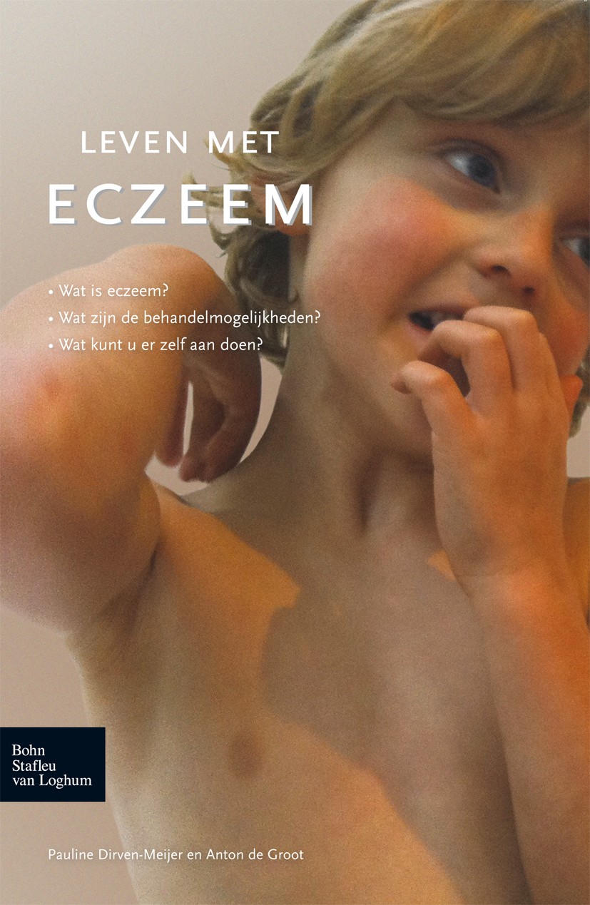 Titlebook: Leven met eczeem; Pauline Dirven-Meijer,Anton Groot Book 2011Latest edition Bohn Stafleu van Loghum 2011 Leven met.eczeem Titlebook: Leven met eczeem; Pauline Dirven-Meijer,Anton Groot Book 2011Latest edition Bohn Stafleu van Loghum 2011 Leven met.eczeem