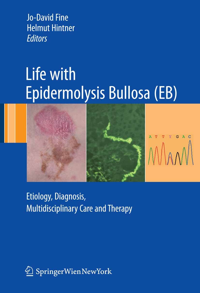 Titlebook: Life with Epidermolysis Bullosa (EB); Etiology, Diagnosis, Jo-David Fine,Helmut Hintner Book 2009 Springer-Verlag Vienna 2009 Butterfly Chi Titlebook: Life with Epidermolysis Bullosa (EB); Etiology, Diagnosis, Jo-David Fine,Helmut Hintner Book 2009 Springer-Verlag Vienna 2009 Butterfly Chi