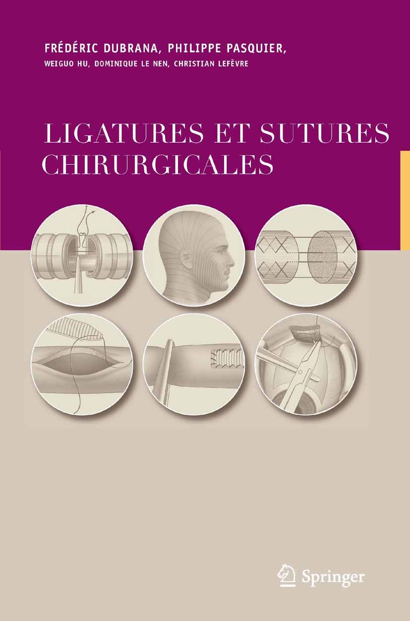 Titlebook: Ligatures et sutures chirurgicales; Techniques chirurgic Frédéric Dubrana,Philippe Pasquier,Christian Lefèv Book 2011Latest edition Springe Titlebook: Ligatures et sutures chirurgicales; Techniques chirurgic Frédéric Dubrana,Philippe Pasquier,Christian Lefèv Book 2011Latest edition Springe