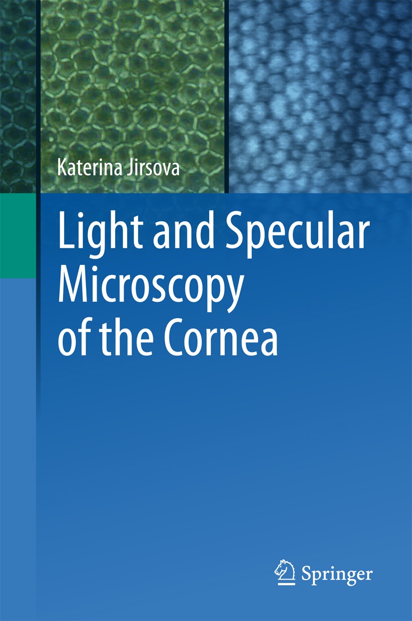 Titlebook: Light and Specular Microscopy of the Cornea; Katerina Jirsova Book 2017 Springer International Publishing AG 2017 Cornea.Cornea Transplant Titlebook: Light and Specular Microscopy of the Cornea; Katerina Jirsova Book 2017 Springer International Publishing AG 2017 Cornea.Cornea Transplant