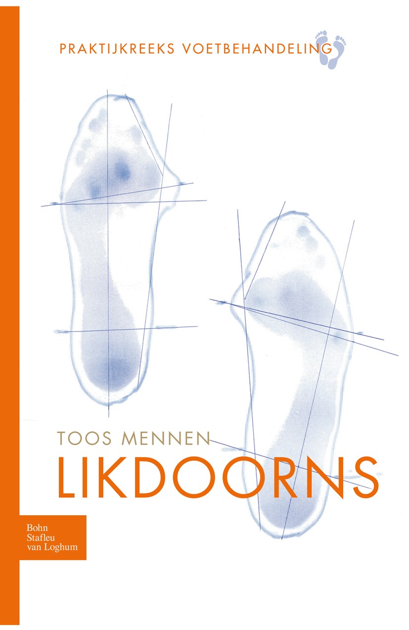 Titlebook: Likdoorns; Toos Mennen Book 2009Latest edition Bohn Stafleu van Loghum 2009 Titlebook: Likdoorns; Toos Mennen Book 2009Latest edition Bohn Stafleu van Loghum 2009