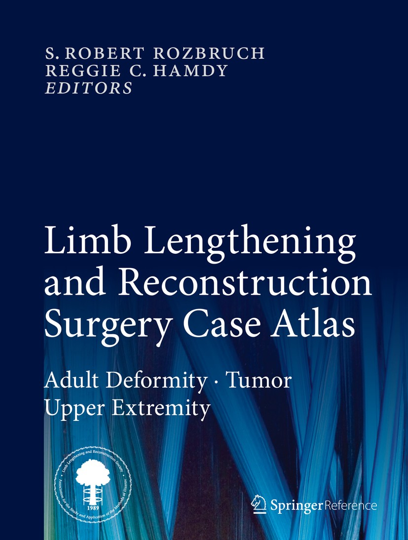 Titlebook: Limb Lengthening and Reconstruction Surgery Case Atlas; Adult Deformity • Tu S. Robert Rozbruch,Reggie C. Hamdy Reference work 2015 Springe Titlebook: Limb Lengthening and Reconstruction Surgery Case Atlas; Adult Deformity • Tu S. Robert Rozbruch,Reggie C. Hamdy Reference work 2015 Springe