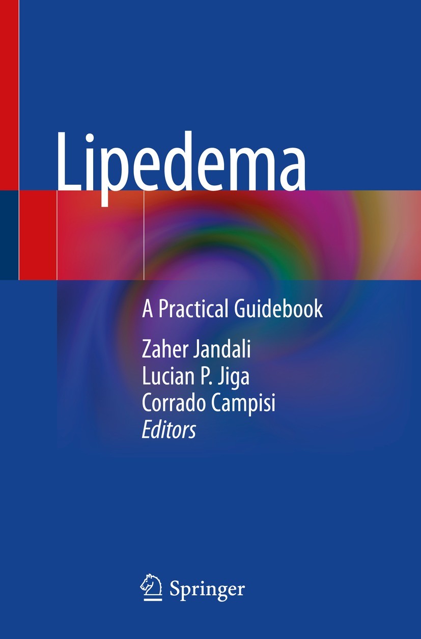 Titlebook: Lipedema; A Practical Guideboo Zaher Jandali,Lucian P. Jiga,Corrado Campisi Book 2022 Springer Nature Switzerland AG 2022 Lipedema.Lipedema Titlebook: Lipedema; A Practical Guideboo Zaher Jandali,Lucian P. Jiga,Corrado Campisi Book 2022 Springer Nature Switzerland AG 2022 Lipedema.Lipedema