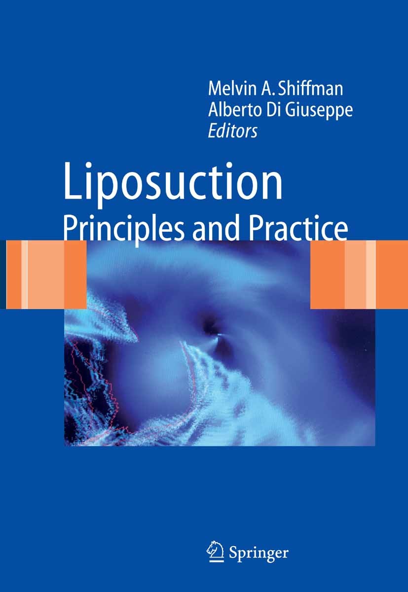 Titlebook: Liposuction; Principles and Pract Melvin A. Shiffman,Alberto Giuseppe Book 20061st edition Springer-Verlag Berlin Heidelberg 2006 Hyperhidr Titlebook: Liposuction; Principles and Pract Melvin A. Shiffman,Alberto Giuseppe Book 20061st edition Springer-Verlag Berlin Heidelberg 2006 Hyperhidr