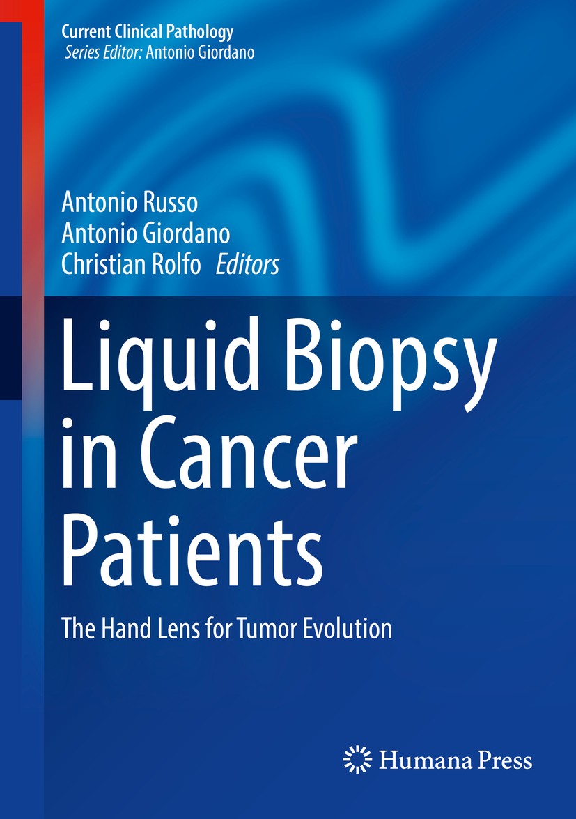 Titlebook: Liquid Biopsy in Cancer Patients; The Hand Lens for Tu Antonio Russo,Antonio Giordano,Christian Rolfo Book 2017 Springer International Publ Titlebook: Liquid Biopsy in Cancer Patients; The Hand Lens for Tu Antonio Russo,Antonio Giordano,Christian Rolfo Book 2017 Springer International Publ
