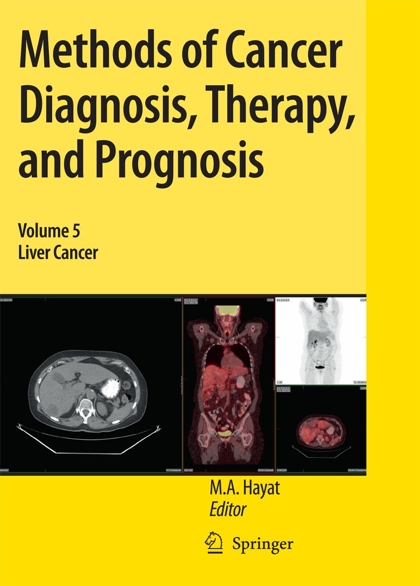Titlebook: Methods of Cancer Diagnosis, Therapy, and Prognosis; Liver Cancer M. A. Hayat Book 20091st edition Springer Science+Business Media B.V. 200 Titlebook: Methods of Cancer Diagnosis, Therapy, and Prognosis; Liver Cancer M. A. Hayat Book 20091st edition Springer Science+Business Media B.V. 200