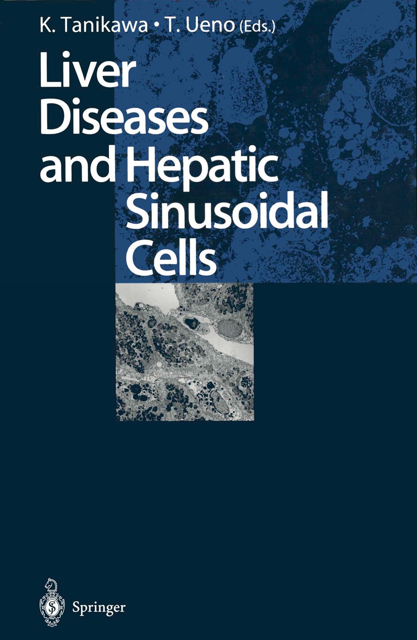 Titlebook: Liver Diseases and Hepatic Sinusoidal Cells; Kyuichi Tanikawa (Professor Emeritus, President),T Conference proceedings 1999 Springer Japan Titlebook: Liver Diseases and Hepatic Sinusoidal Cells; Kyuichi Tanikawa (Professor Emeritus, President),T Conference proceedings 1999 Springer Japan