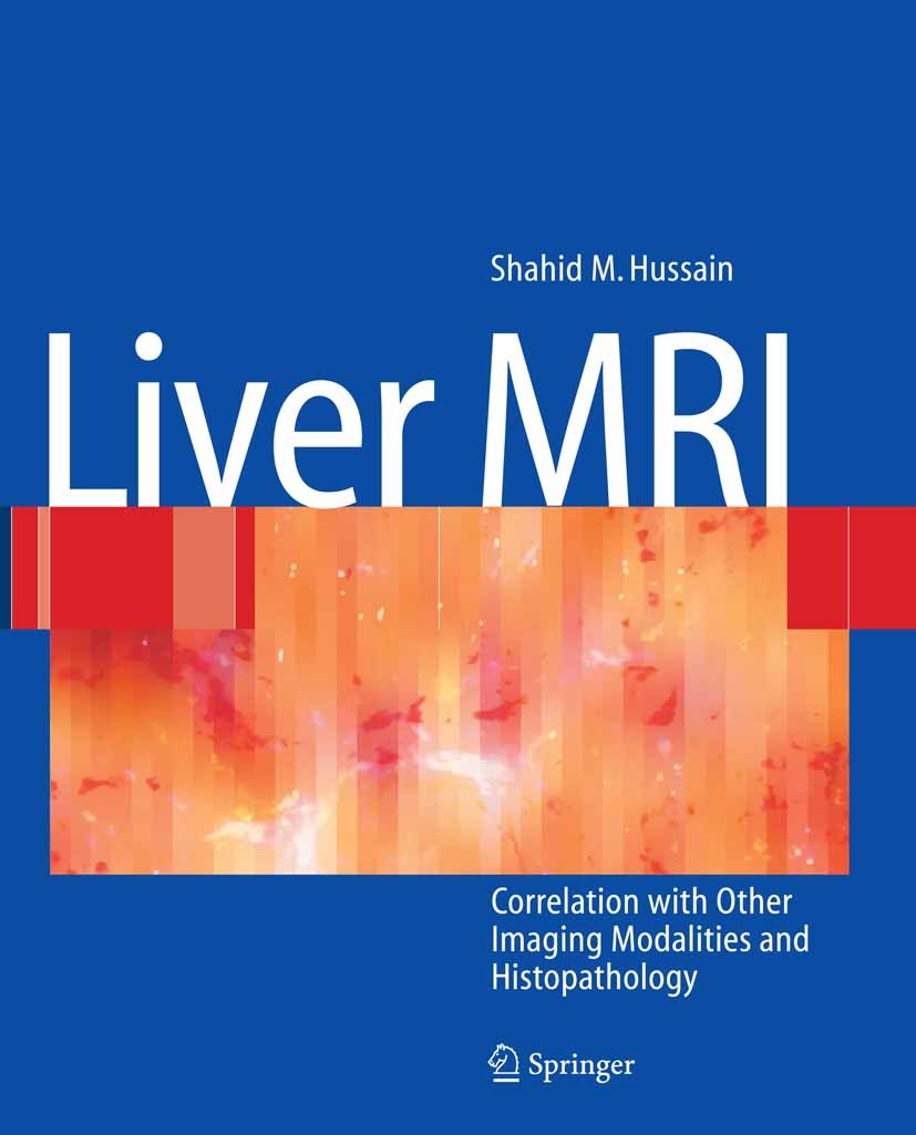 Titlebook: Liver MRI; Correlation with oth Shahid M. Hussain Book 20071st edition Springer-Verlag Berlin Heidelberg 2007 Liver Lesion.computed tomogra Titlebook: Liver MRI; Correlation with oth Shahid M. Hussain Book 20071st edition Springer-Verlag Berlin Heidelberg 2007 Liver Lesion.computed tomogra