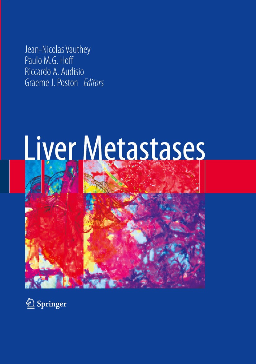 Titlebook: Liver Metastases; Jean-Nicolas Vauthey,Paulo M. Hoff,Graeme J. Posto Book 2009 Springer-Verlag London 2009 Liver Cancer.Liver Carcinoma.Li Titlebook: Liver Metastases; Jean-Nicolas Vauthey,Paulo M. Hoff,Graeme J. Posto Book 2009 Springer-Verlag London 2009 Liver Cancer.Liver Carcinoma.Li