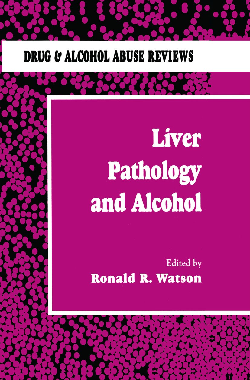 Titlebook: Liver Pathology and Alcohol; Drug & Alcohol Abuse Ronald R. Watson Book 1991 Springer Science+Business Media New York 1991 cancer.cell.live Titlebook: Liver Pathology and Alcohol; Drug & Alcohol Abuse Ronald R. Watson Book 1991 Springer Science+Business Media New York 1991 cancer.cell.live