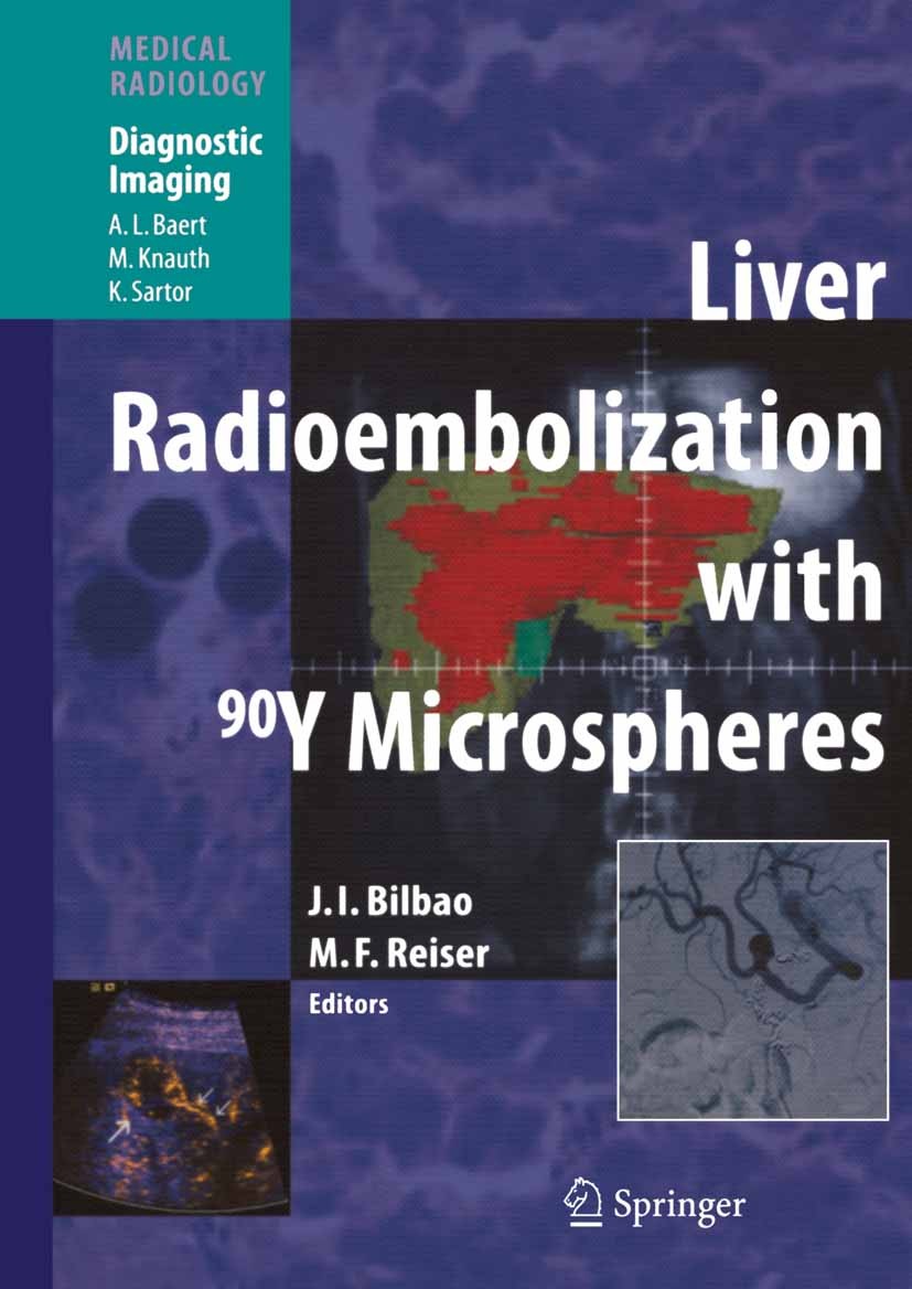 Titlebook: Liver Radioembolization with 90Y Microspheres; José I. Bilbao (Professor),Maximilian F. Reiser (P Book 20081st edition Springer-Verlag Ber Titlebook: Liver Radioembolization with 90Y Microspheres; José I. Bilbao (Professor),Maximilian F. Reiser (P Book 20081st edition Springer-Verlag Ber