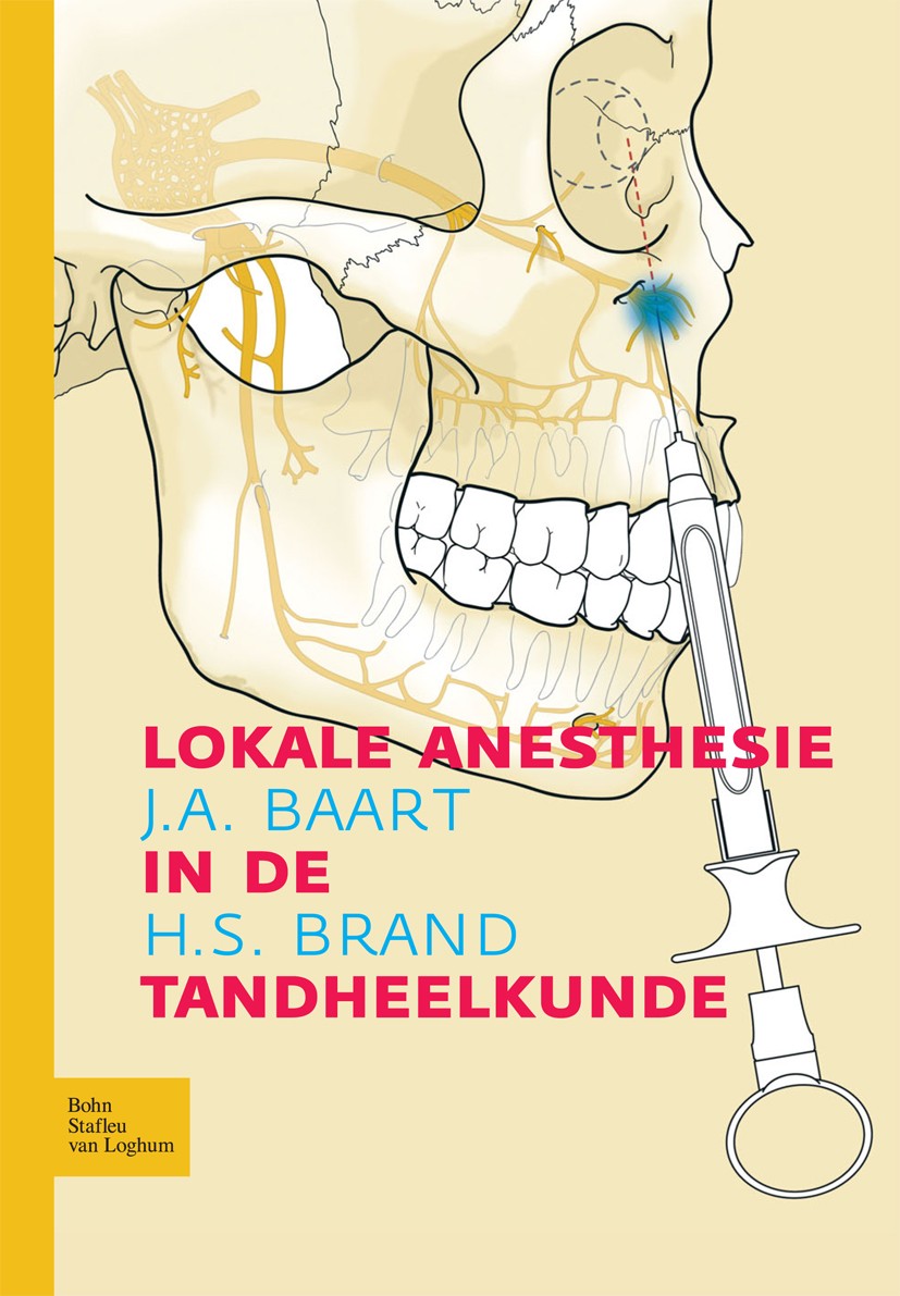 Titlebook: Lokale anesthesie in de tandheelkunde; J.A. Baart,H.S. Brand Book 2006Latest edition Bohn Stafleu van Loghum 2006 Titlebook: Lokale anesthesie in de tandheelkunde; J.A. Baart,H.S. Brand Book 2006Latest edition Bohn Stafleu van Loghum 2006
