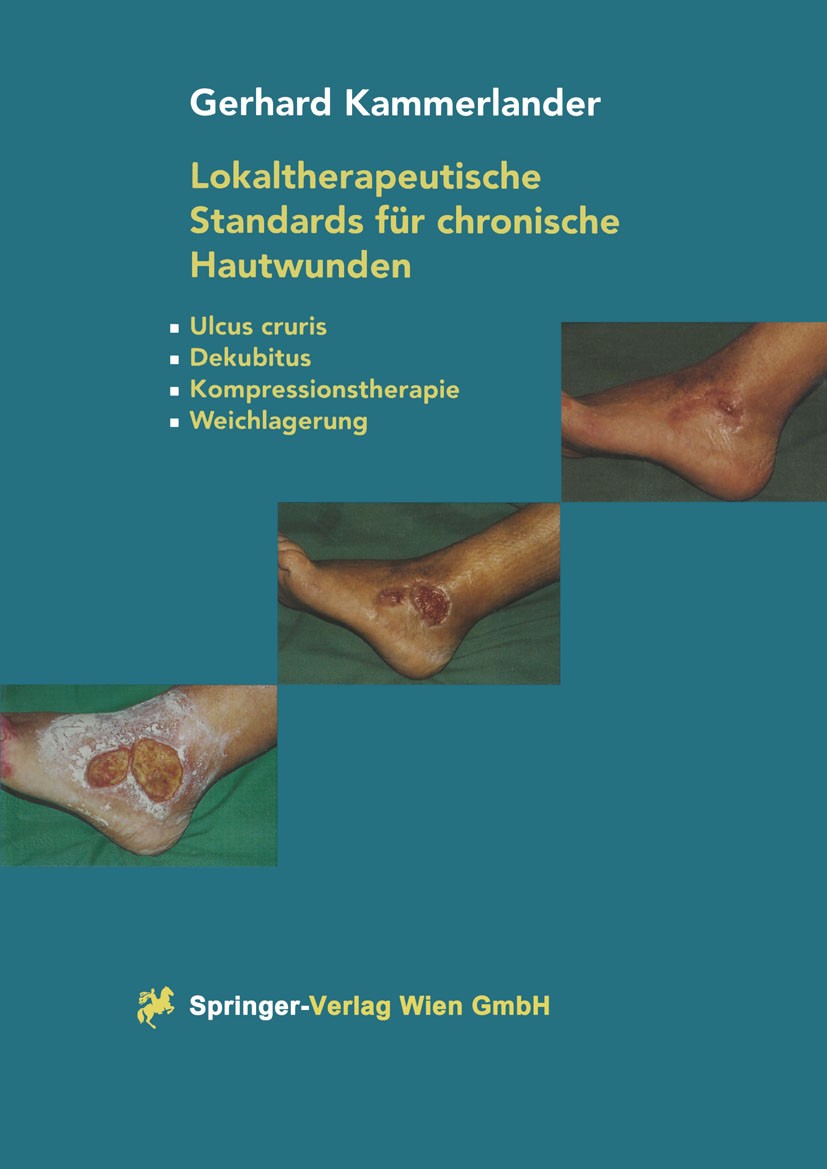 Titlebook: Lokaltherapeutische Standards für chronische Hautwunden; Ulcus cruris - Dekub Gerhard Kammerlander Book 19981st edition Springer-Verlag Vie Titlebook: Lokaltherapeutische Standards für chronische Hautwunden; Ulcus cruris - Dekub Gerhard Kammerlander Book 19981st edition Springer-Verlag Vie