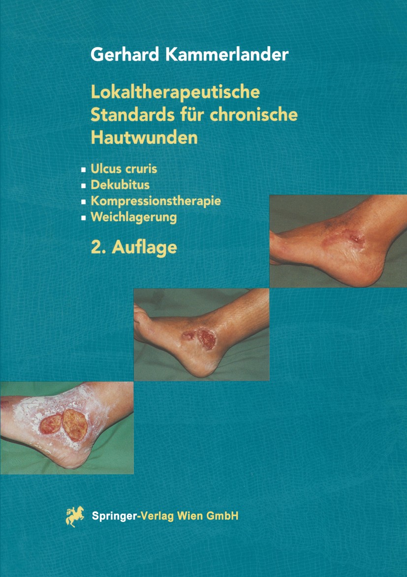 Titlebook: Lokaltherapeutische Standards für chronische Hautwunden; Ulcus cruris - Dekub Gerhard Kammerlander Textbook 20012nd edition Springer-Verlag Titlebook: Lokaltherapeutische Standards für chronische Hautwunden; Ulcus cruris - Dekub Gerhard Kammerlander Textbook 20012nd edition Springer-Verlag