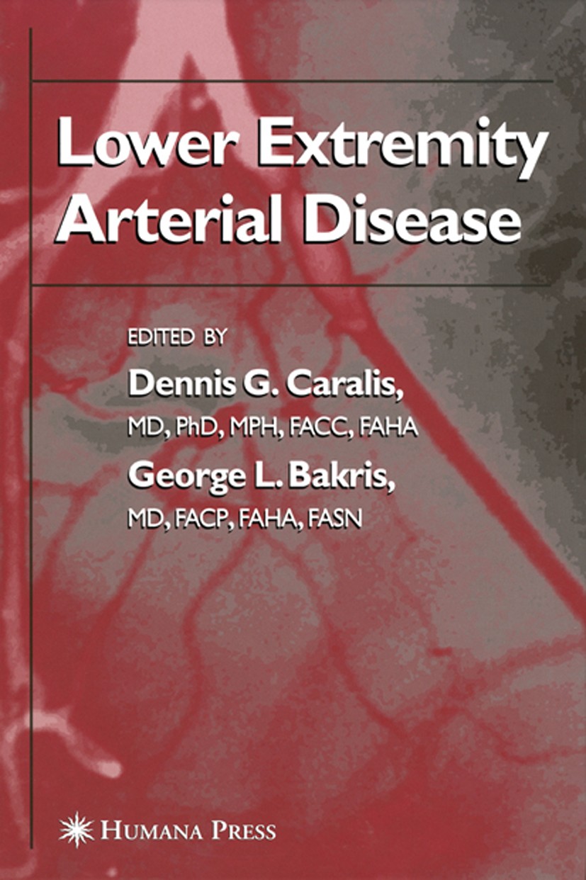Titlebook: Lower Extremity Arterial Disease; Dennis G. Caralis,George L. Bakris Book 2005 Humana Press 2005 Diabetes.Stent.angiography.arteries.ather Titlebook: Lower Extremity Arterial Disease; Dennis G. Caralis,George L. Bakris Book 2005 Humana Press 2005 Diabetes.Stent.angiography.arteries.ather