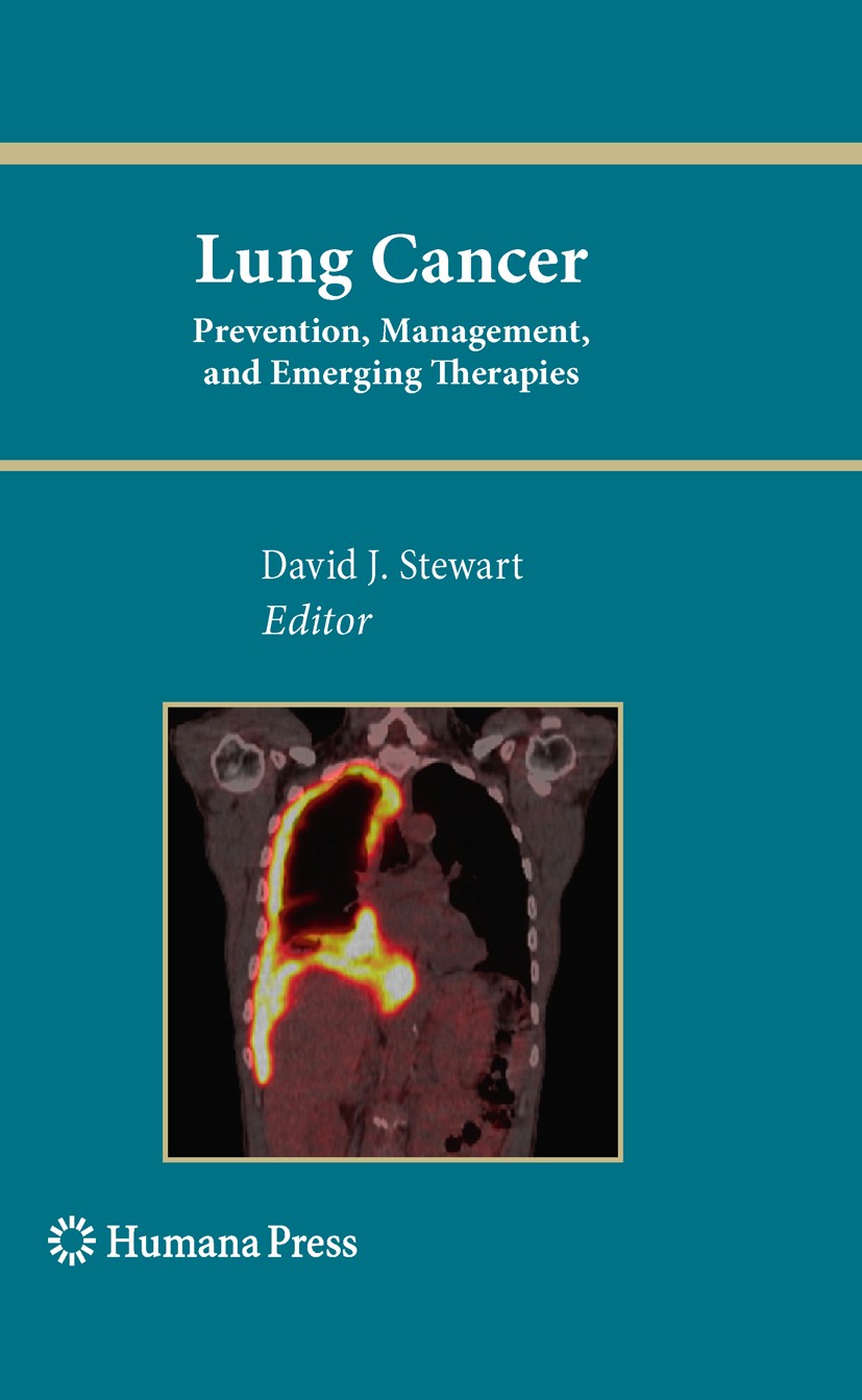 Titlebook: Lung Cancer:; Prevention, Manageme David J. Stewart Book 2010 Humana Press 2010 Antiangiogenesis.Cancer.Carcinom.Clinical trials.Lung.Malig Titlebook: Lung Cancer:; Prevention, Manageme David J. Stewart Book 2010 Humana Press 2010 Antiangiogenesis.Cancer.Carcinom.Clinical trials.Lung.Malig