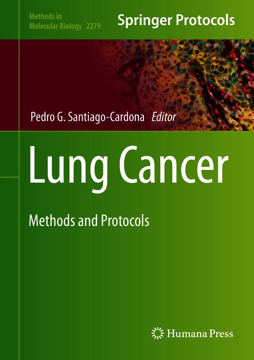 Titlebook: Lung Cancer; Methods and Protocol Pedro G. Santiago-Cardona Book 2021 Springer Science+Business Media, LLC, part of Springer Nature 2021 Lu Titlebook: Lung Cancer; Methods and Protocol Pedro G. Santiago-Cardona Book 2021 Springer Science+Business Media, LLC, part of Springer Nature 2021 Lu