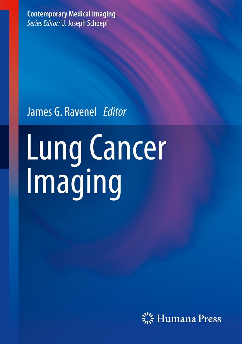 Titlebook: Lung Cancer Imaging; James G. Ravenel Book 2013 Springer Science+Business Media New York 2013 Chemotherapy.Drug Toxicity.Epidemiology.Imag Titlebook: Lung Cancer Imaging; James G. Ravenel Book 2013 Springer Science+Business Media New York 2013 Chemotherapy.Drug Toxicity.Epidemiology.Imag
