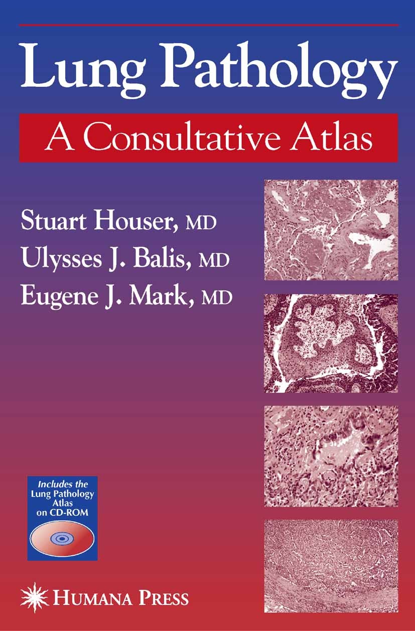 Titlebook: Lung Pathology; Stuart Houser,Ulysses J. Balis,Eugene J. Mark Book 2005 Humana Press 2005 diagnosis.differential diagnosis.histology.infec Titlebook: Lung Pathology; Stuart Houser,Ulysses J. Balis,Eugene J. Mark Book 2005 Humana Press 2005 diagnosis.differential diagnosis.histology.infec
