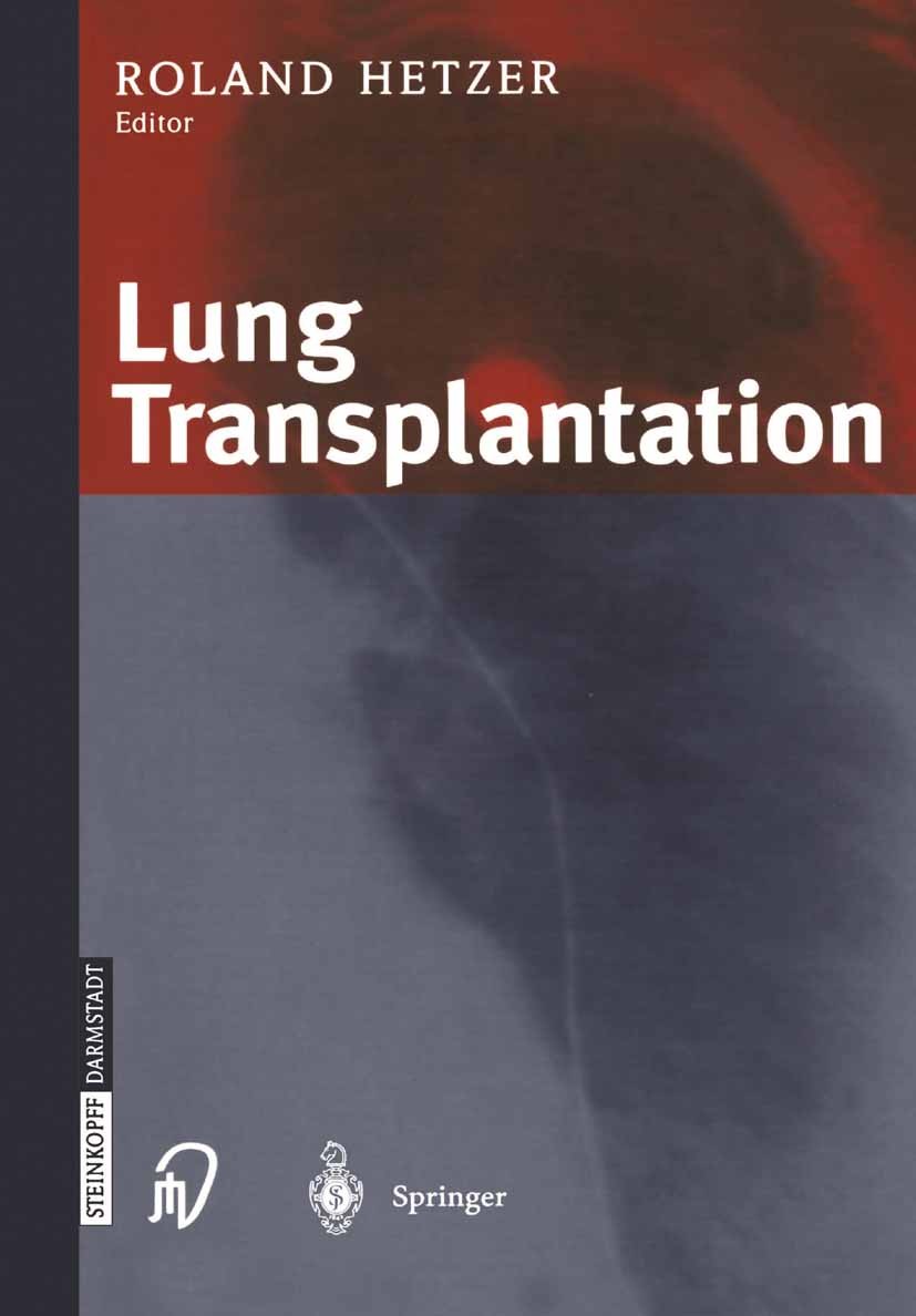 Titlebook: Lung Transplantation; Roland Hetzer Conference proceedings 2003 Springer-Verlag Berlin Heidelberg 2003 Lung transplantation.bronchial comp Titlebook: Lung Transplantation; Roland Hetzer Conference proceedings 2003 Springer-Verlag Berlin Heidelberg 2003 Lung transplantation.bronchial comp