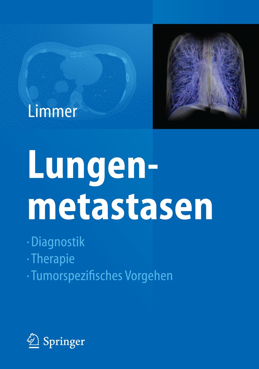 Titlebook: Lungenmetastasen; Diagnostik - Therap Stefan Limmer Book 2015 Springer-Verlag Berlin Heidelberg 2015 Bildgebung der Lunge.Lungenmetastasen Titlebook: Lungenmetastasen; Diagnostik - Therap Stefan Limmer Book 2015 Springer-Verlag Berlin Heidelberg 2015 Bildgebung der Lunge.Lungenmetastasen