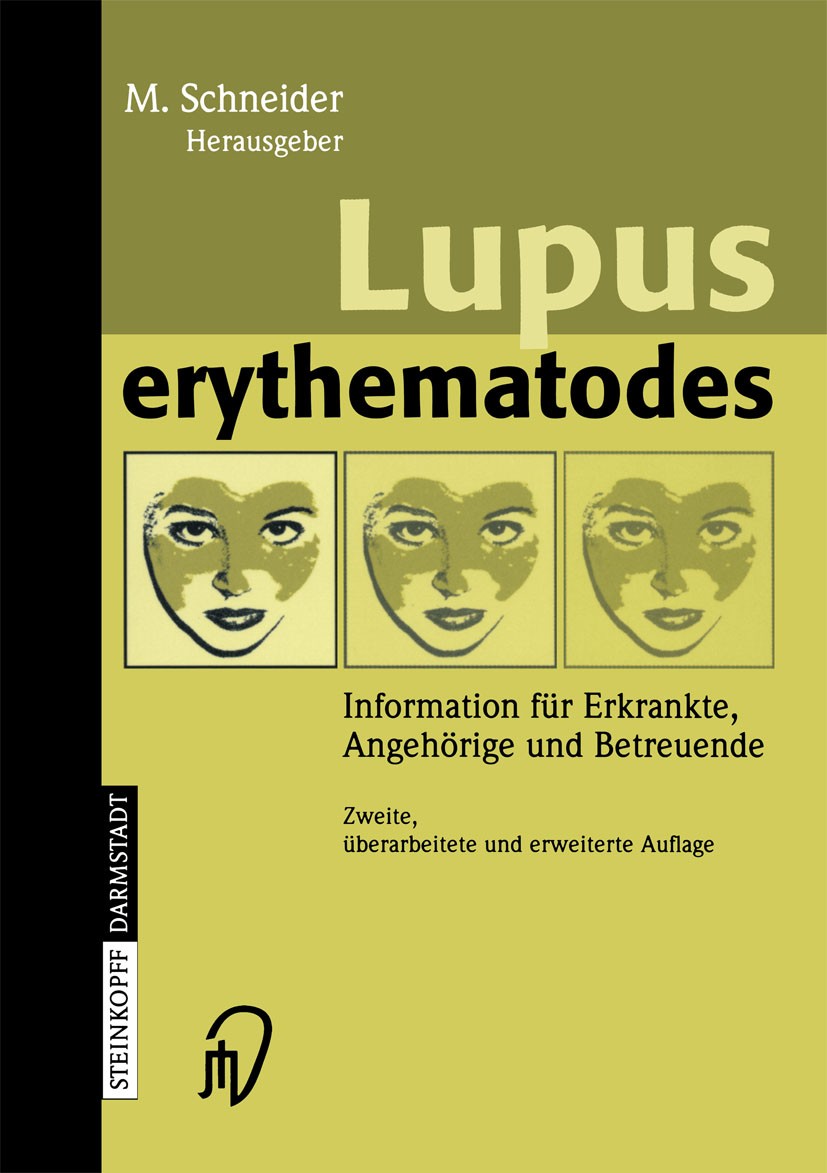 Titlebook: Lupus erythematodes; Information für Erkr Matthias Schneider Book 20042nd edition Springer-Verlag Berlin Heidelberg 2004 Autoimmunerkrankun Titlebook: Lupus erythematodes; Information für Erkr Matthias Schneider Book 20042nd edition Springer-Verlag Berlin Heidelberg 2004 Autoimmunerkrankun