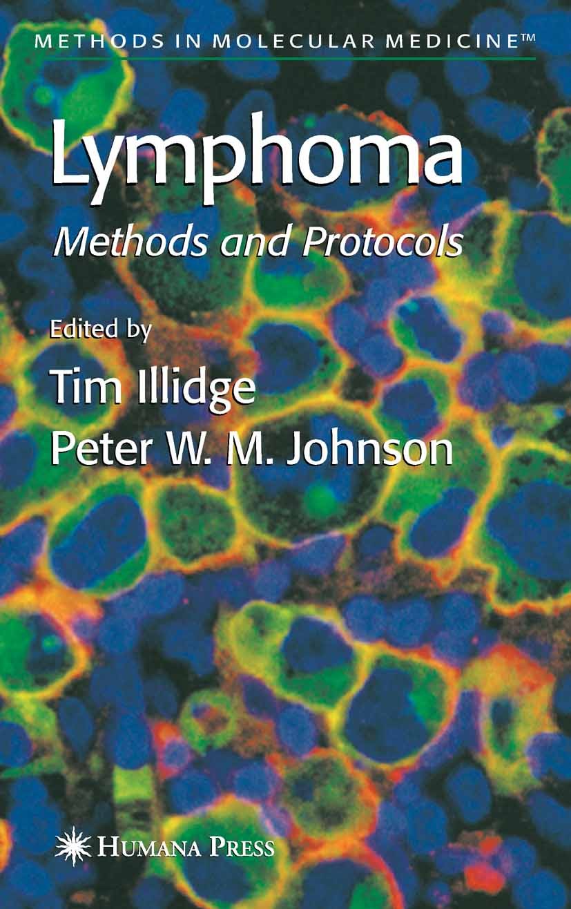 Titlebook: Lymphoma; Tim Illidge,Peter W. M. Johnson Book 2005 Humana Press 2005 DNA.biopsy.chemistry.leukemia.lymphoma Titlebook: Lymphoma; Tim Illidge,Peter W. M. Johnson Book 2005 Humana Press 2005 DNA.biopsy.chemistry.leukemia.lymphoma