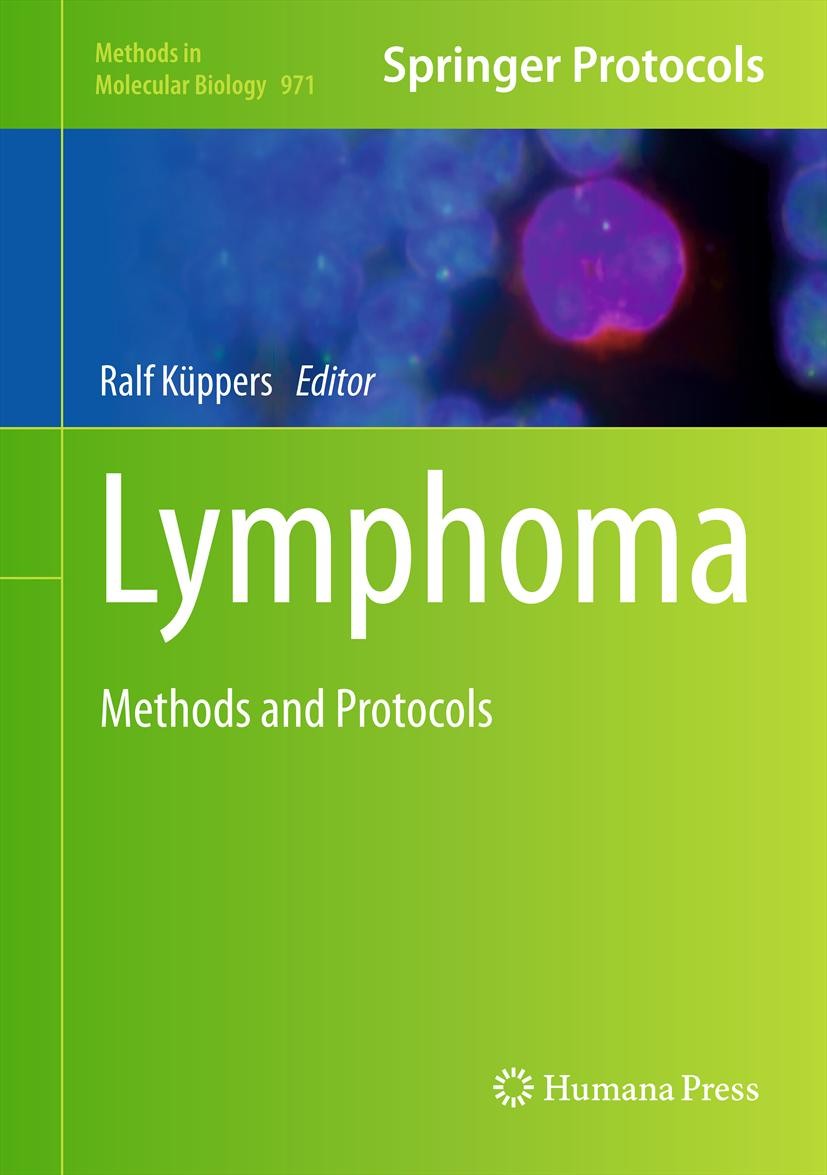 Titlebook: Lymphoma; Methods and Protocol Ralf Küppers Book 2013 Springer Science+Business Media, LLC 2013 B and T cell lymphomas.Cancer research.Chro Titlebook: Lymphoma; Methods and Protocol Ralf Küppers Book 2013 Springer Science+Business Media, LLC 2013 B and T cell lymphomas.Cancer research.Chro