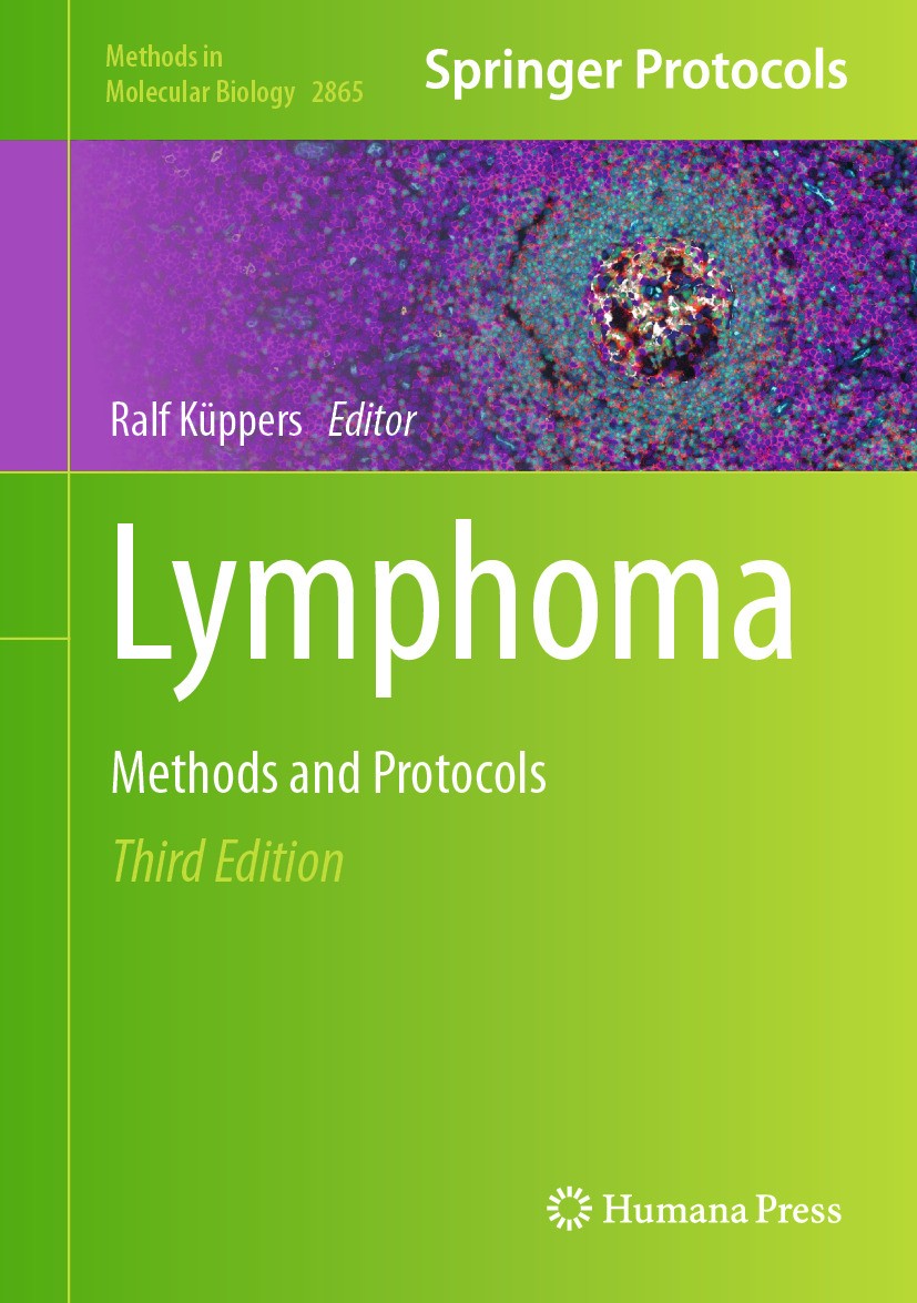 Titlebook: Lymphoma; Methods and Protocol Ralf Küppers Book 2025Latest edition The Editor(s) (if applicable) and The Author(s), under exclusive licens Titlebook: Lymphoma; Methods and Protocol Ralf Küppers Book 2025Latest edition The Editor(s) (if applicable) and The Author(s), under exclusive licens