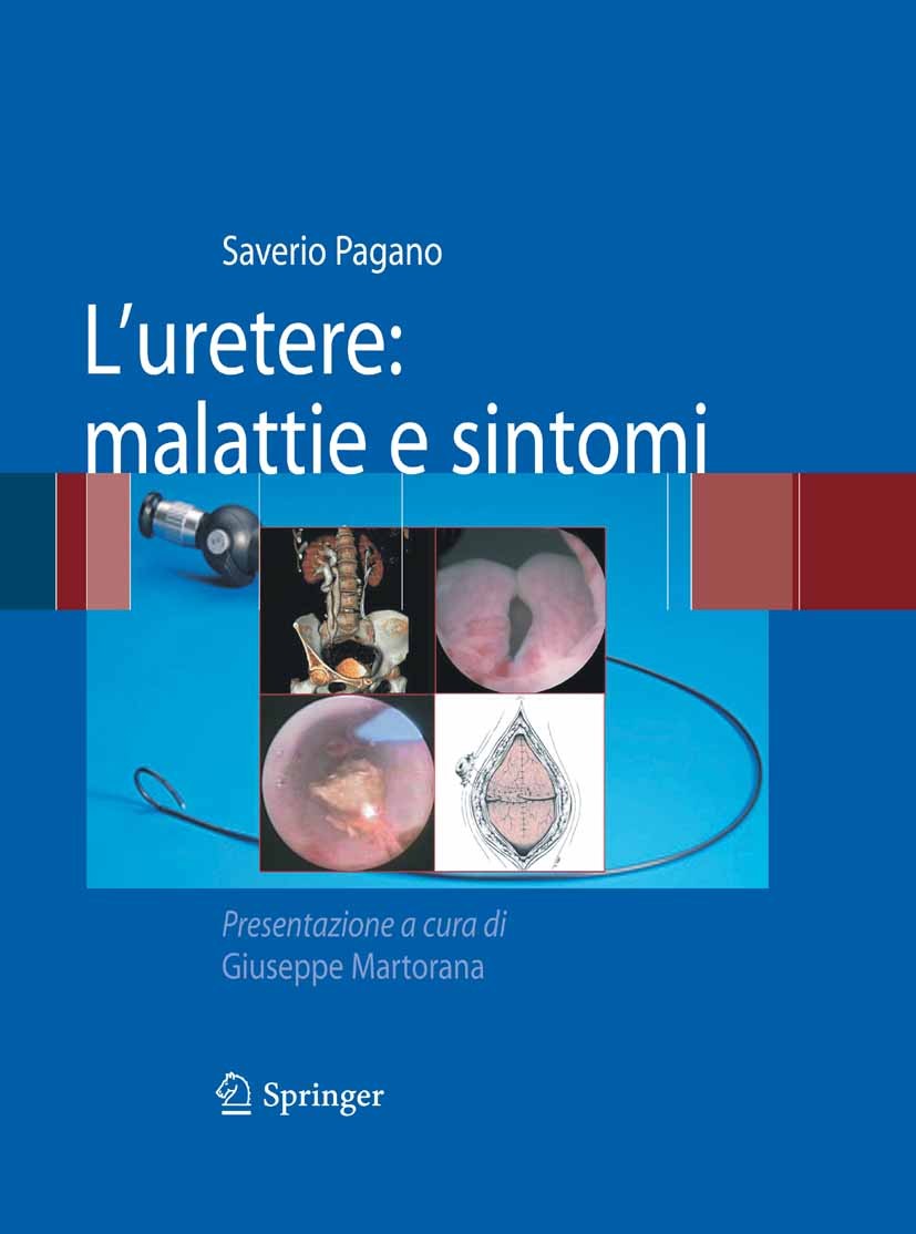 Titlebook: L‘uretere: malattie e sintomi; Saverio Pagano Book 2010 Springer-Verlag Milan 2010 Malattie ureterali.Tumor.chirurgia uretrale.endoscopy.e Titlebook: L‘uretere: malattie e sintomi; Saverio Pagano Book 2010 Springer-Verlag Milan 2010 Malattie ureterali.Tumor.chirurgia uretrale.endoscopy.e