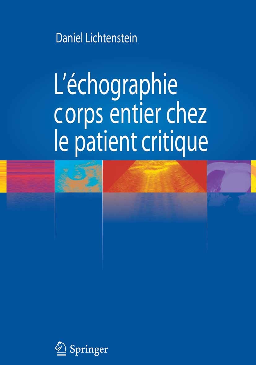 Titlebook: L’échographie corps entier chez le patient critique; Daniel A. Lichtenstein Book 2011Latest edition Springer-Verlag France 2011 Blue Proto Titlebook: L’échographie corps entier chez le patient critique; Daniel A. Lichtenstein Book 2011Latest edition Springer-Verlag France 2011 Blue Proto