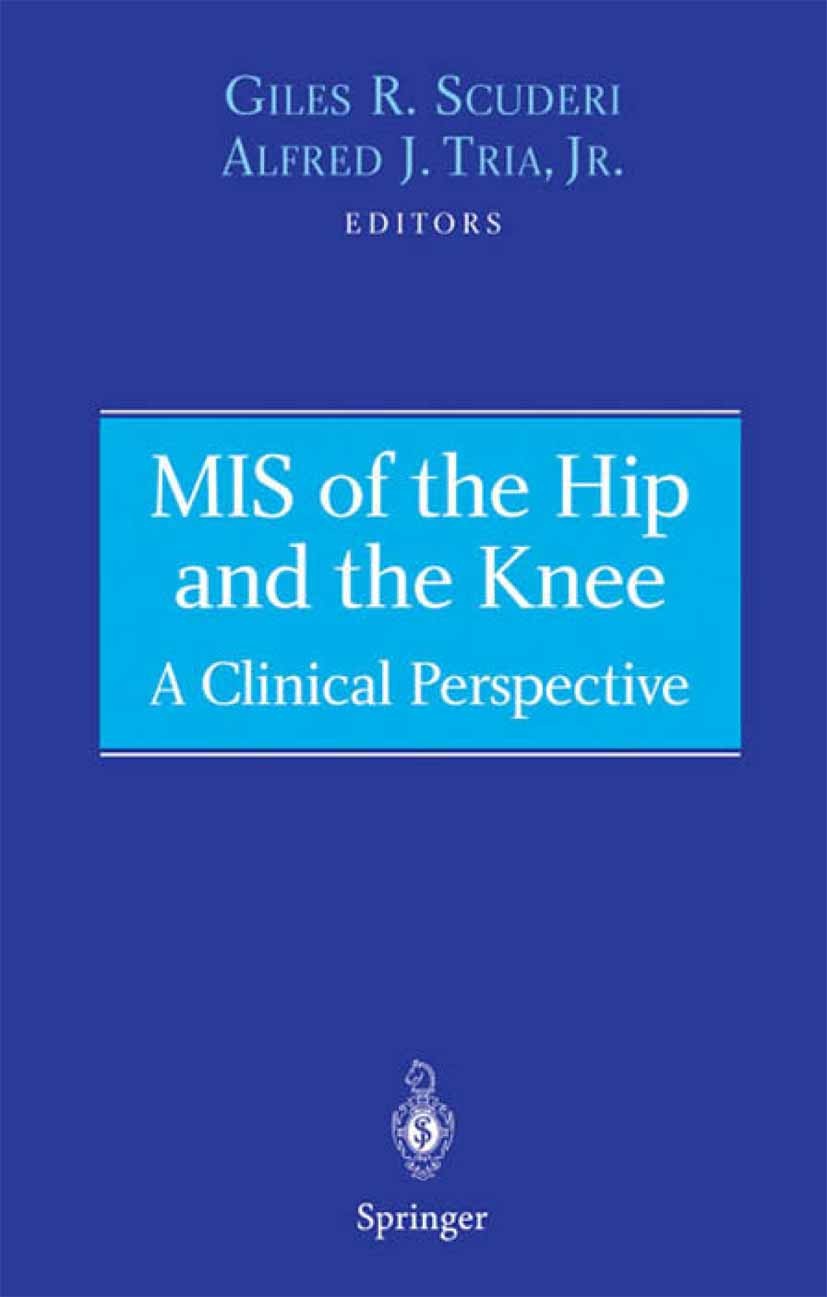 Titlebook: MIS of the Hip and the Knee; A Clinical Perspecti Giles R. Scuderi (Chief of Adult Knee Reconstructi Book 2004 Springer Science+Business Me Titlebook: MIS of the Hip and the Knee; A Clinical Perspecti Giles R. Scuderi (Chief of Adult Knee Reconstructi Book 2004 Springer Science+Business Me