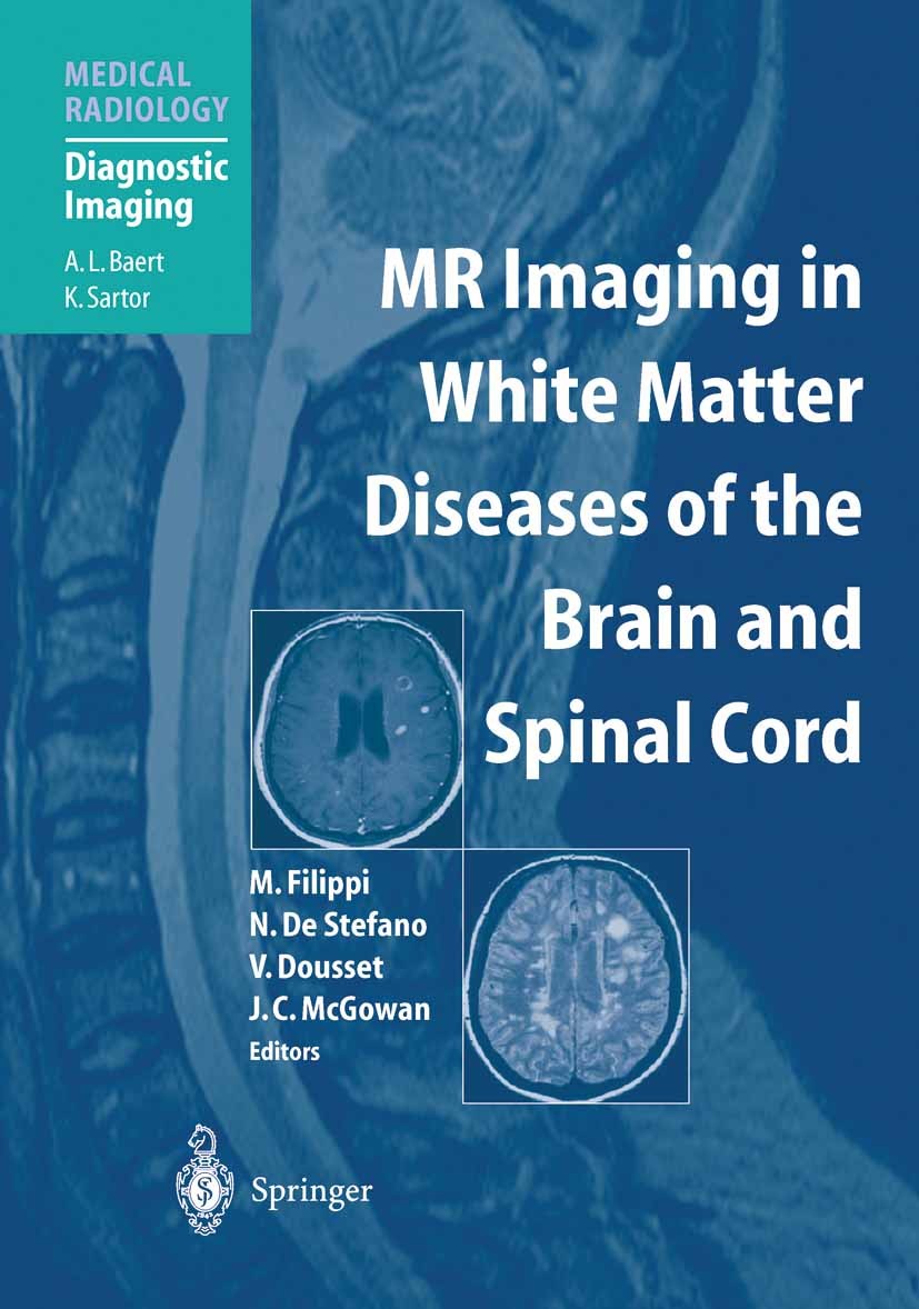 Titlebook: MR Imaging in White Matter Diseases of the Brain and Spinal Cord; Massimo Filippi (Director),Nicola Stefano (Associa Book 2005 Springer-Ve Titlebook: MR Imaging in White Matter Diseases of the Brain and Spinal Cord; Massimo Filippi (Director),Nicola Stefano (Associa Book 2005 Springer-Ve