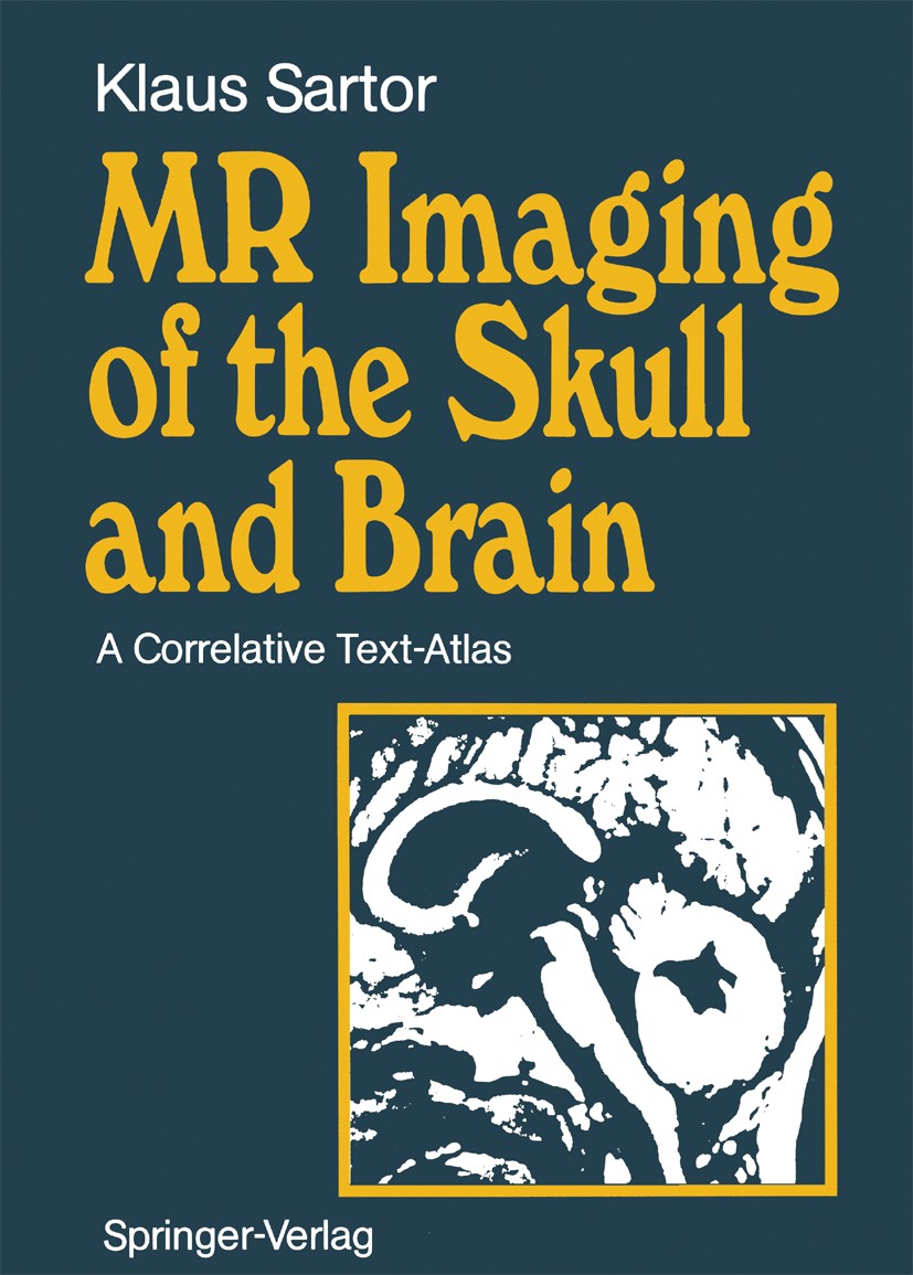 Titlebook: MR Imaging of the Skull and Brain; A Correlative Text-A Klaus Sartor Book 1992 Springer-Verlag Berlin Heidelberg 1992 Alzheimer´s disease.H Titlebook: MR Imaging of the Skull and Brain; A Correlative Text-A Klaus Sartor Book 1992 Springer-Verlag Berlin Heidelberg 1992 Alzheimer´s disease.H