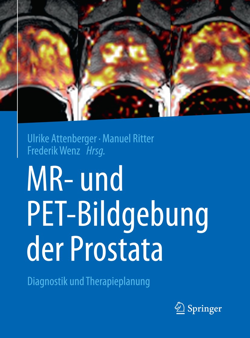 Titlebook: MR- und PET-Bildgebung der Prostata; Diagnostik und Thera Ulrike Attenberger,Manuel Ritter,Frederik Wenz Book 2017 Springer-Verlag GmbH Deu Titlebook: MR- und PET-Bildgebung der Prostata; Diagnostik und Thera Ulrike Attenberger,Manuel Ritter,Frederik Wenz Book 2017 Springer-Verlag GmbH Deu