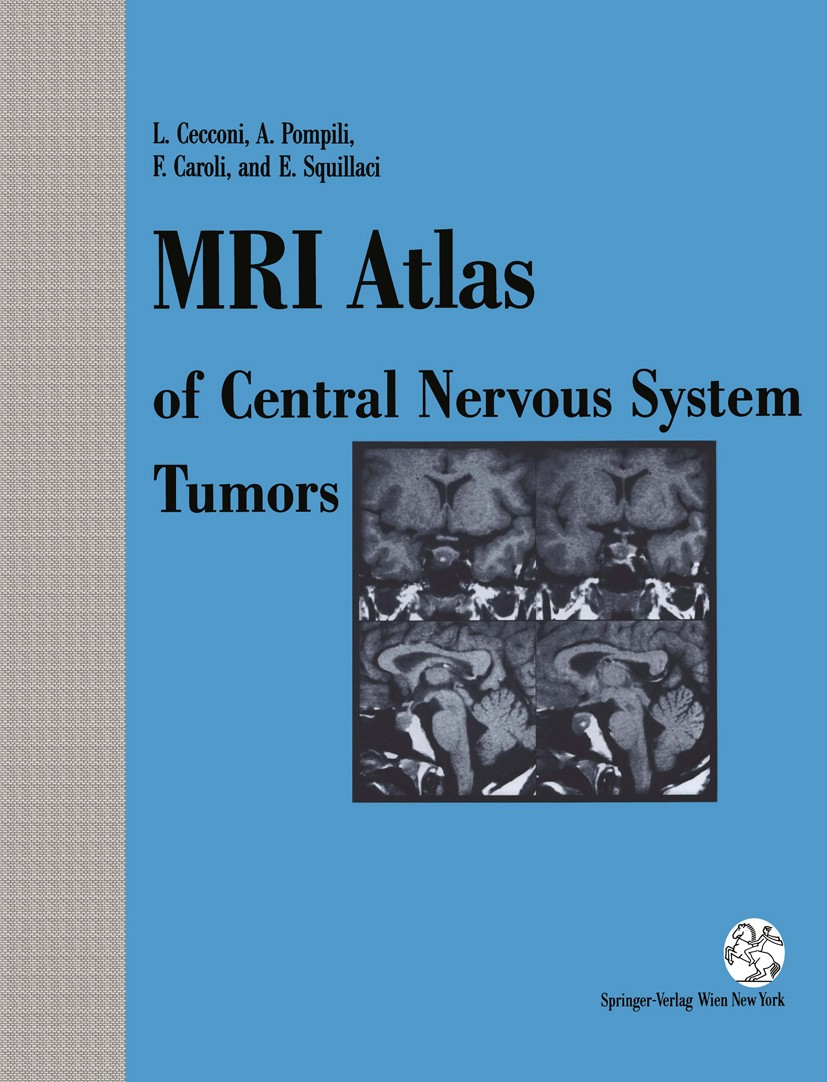 Titlebook: MRI Atlas of Central Nervous System Tumors; Lucia Cecconi,Alfredo Pompili,Ettore Squillaci Book 1992 Springer-Verlag/Wien 1992 Nervous Sys Titlebook: MRI Atlas of Central Nervous System Tumors; Lucia Cecconi,Alfredo Pompili,Ettore Squillaci Book 1992 Springer-Verlag/Wien 1992 Nervous Sys