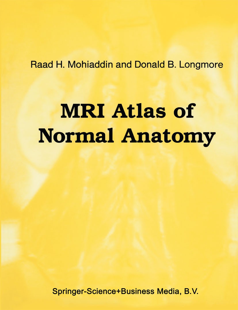 Titlebook: MRI Atlas of Normal Anatomy; Raad H. Mohiaddin,Donald B. Longmore Book 1992 Springer Science+Business Media Dordrecht 1992 X-ray.anatomy.c Titlebook: MRI Atlas of Normal Anatomy; Raad H. Mohiaddin,Donald B. Longmore Book 1992 Springer Science+Business Media Dordrecht 1992 X-ray.anatomy.c
