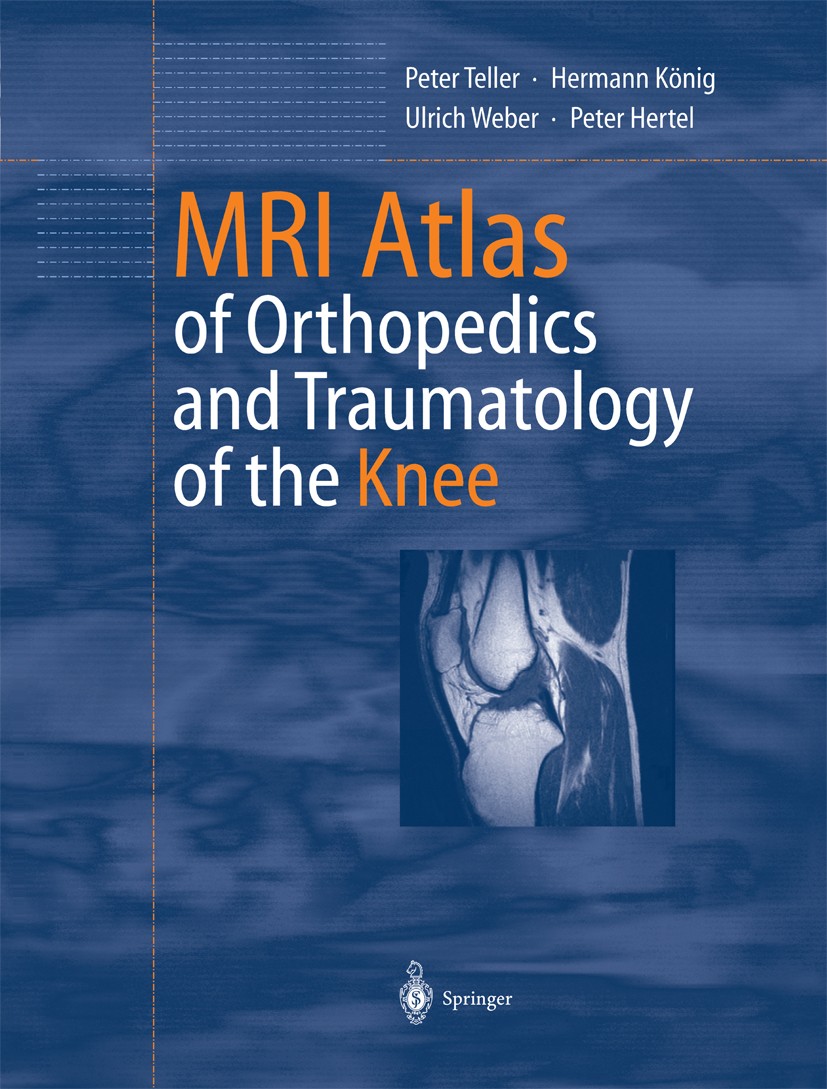 Titlebook: MRI Atlas of Orthopedics and Traumatology of the Knee; Peter Teller,Hermann König,Peter Hertel Book 2003 Springer-Verlag Berlin Heidelberg Titlebook: MRI Atlas of Orthopedics and Traumatology of the Knee; Peter Teller,Hermann König,Peter Hertel Book 2003 Springer-Verlag Berlin Heidelberg
