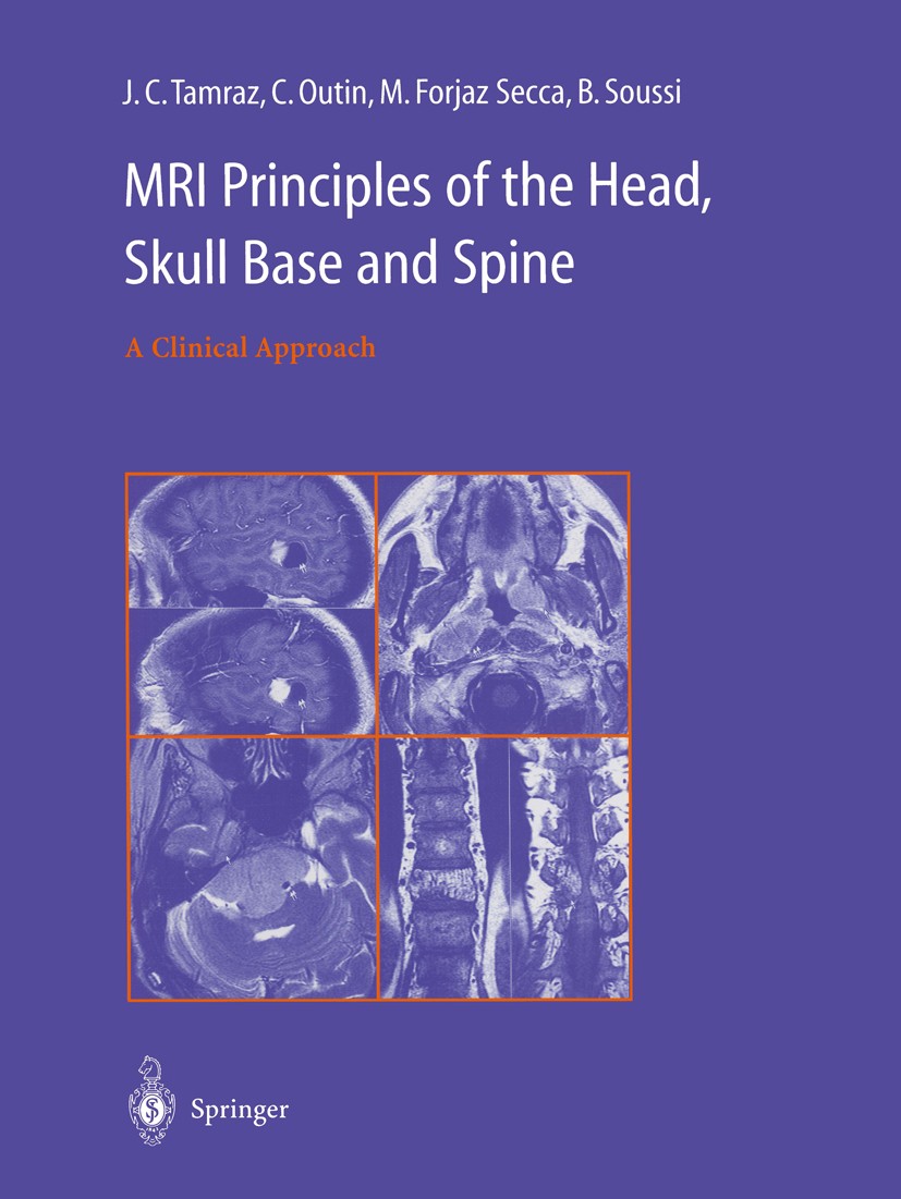 Titlebook: MRI Principles of the Head, Skull Base and Spine; A Clinical Approach Jean C. Tamraz,Claire Outin,Bassam Soussi Book 2003 Springer-Verlag F Titlebook: MRI Principles of the Head, Skull Base and Spine; A Clinical Approach Jean C. Tamraz,Claire Outin,Bassam Soussi Book 2003 Springer-Verlag F