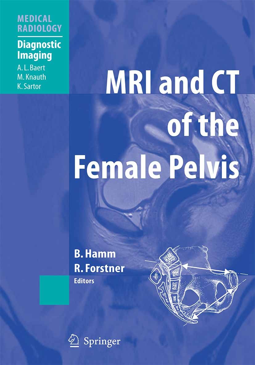 Titlebook: MRI and CT of the Female Pelvis; Bernd Hamm (Professor and Chairman),Rosemarie Fors Book 20071st edition Springer-Verlag Berlin Heidelberg Titlebook: MRI and CT of the Female Pelvis; Bernd Hamm (Professor and Chairman),Rosemarie Fors Book 20071st edition Springer-Verlag Berlin Heidelberg