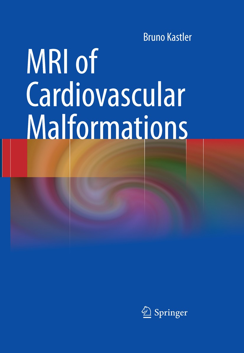 Titlebook: MRI of Cardiovascular Malformations; Bruno Kastler Book 2011 Springer-Verlag Berlin Heidelberg 2011 Abnormalities.Cardiac Anomalies.Cardio Titlebook: MRI of Cardiovascular Malformations; Bruno Kastler Book 2011 Springer-Verlag Berlin Heidelberg 2011 Abnormalities.Cardiac Anomalies.Cardio