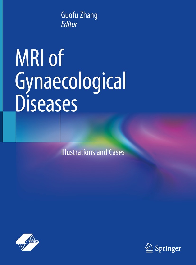 Titlebook: MRI of Gynaecological Diseases; Illustrations and Ca Guofu Zhang Book 2023 Shanghai Scientific and Technical Publishers 2023 MRI imaging.Ut Titlebook: MRI of Gynaecological Diseases; Illustrations and Ca Guofu Zhang Book 2023 Shanghai Scientific and Technical Publishers 2023 MRI imaging.Ut