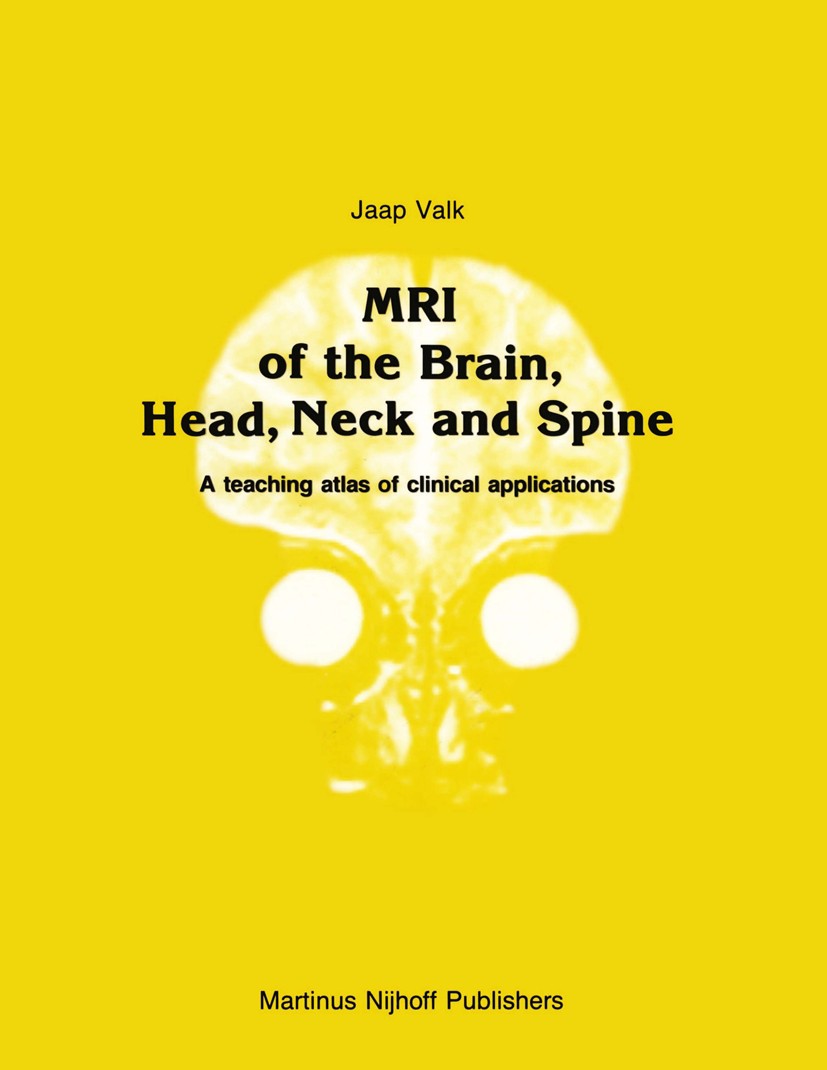 Titlebook: MRI of the Brain, Head, Neck and Spine; A teaching atlas of Jaap Valk Book 1987 Martinus Nijhoff Publishers, Dordrecht 1987 brain.magnetic Titlebook: MRI of the Brain, Head, Neck and Spine; A teaching atlas of Jaap Valk Book 1987 Martinus Nijhoff Publishers, Dordrecht 1987 brain.magnetic