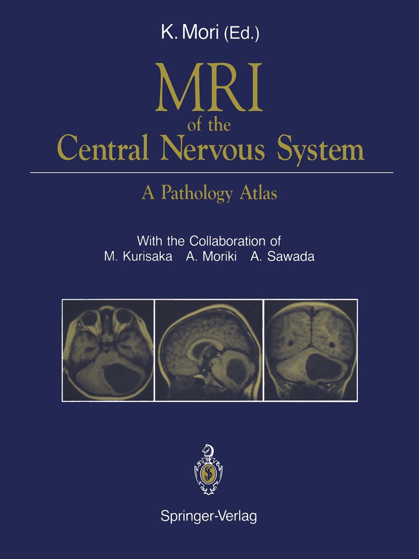 Titlebook: MRI of the Central Nervous System; A Pathology Atlas Koreaki Mori Book 1991 Springer-Verlag Tokyo 1991 Neurochirurgie.Neuroradiologie.Tumor Titlebook: MRI of the Central Nervous System; A Pathology Atlas Koreaki Mori Book 1991 Springer-Verlag Tokyo 1991 Neurochirurgie.Neuroradiologie.Tumor