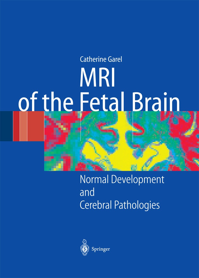 Titlebook: MRI of the Fetal Brain; Normal Development a Catherine Garel Book 2004 Springer-Verlag Berlin Heidelberg 2004 Brain: Growth and development Titlebook: MRI of the Fetal Brain; Normal Development a Catherine Garel Book 2004 Springer-Verlag Berlin Heidelberg 2004 Brain: Growth and development
