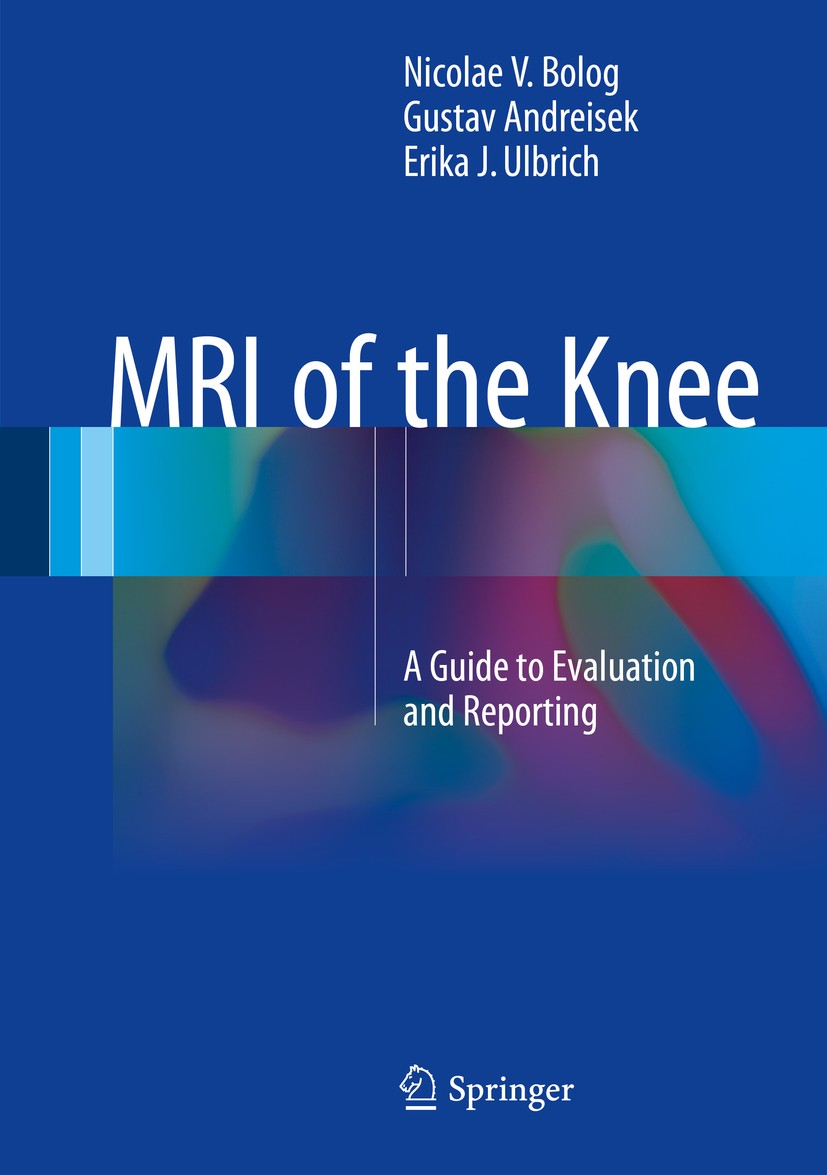 Titlebook: MRI of the Knee; A Guide to Evaluatio Nicolae V. Bolog,Gustav Andreisek,Erika J. Ulbrich Book 2015 Springer International Publishing Switze Titlebook: MRI of the Knee; A Guide to Evaluatio Nicolae V. Bolog,Gustav Andreisek,Erika J. Ulbrich Book 2015 Springer International Publishing Switze